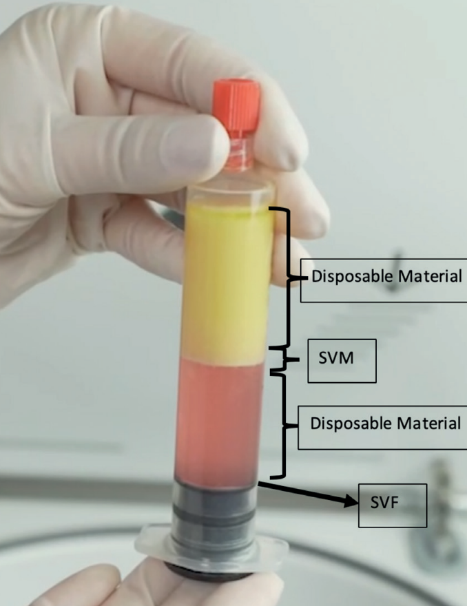 Lipocube™ SVF Aufbereitungssystem - Studienauszug zum Thema Stromal Vascular Matrix - wie Lipocube™ Mechanisch stammzellen gewinnt.